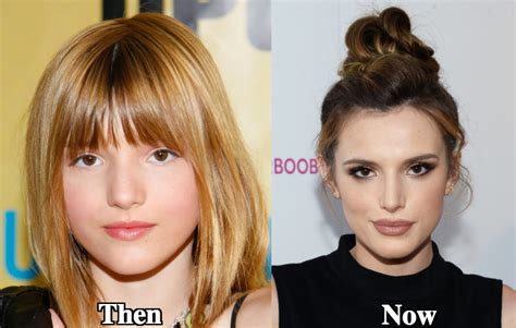 Bella Thorne Plastic Surgery Before And After Photos