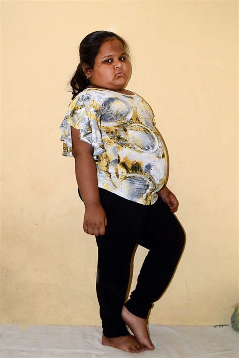 Eight Year Old Indian Girl Tips Scales At More Than Nine