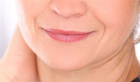 thin lips lip fillers   dr haus dermatology