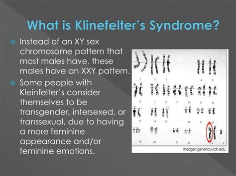 Ppt Klinefelters Syndrome Powerpoint Presentation Id Free Download