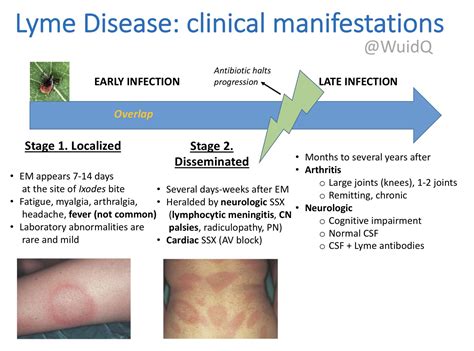 Lyme Disease Early And Late Clinical Manifestations Stage Grepmed
