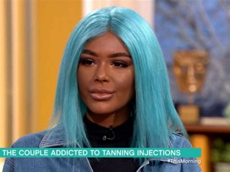 What Are ‘melanotan Injections Explaining The Controversial Tanning