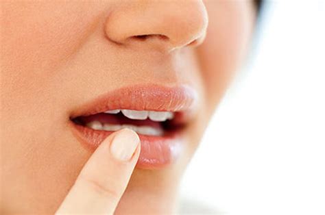 7 Home Remedies To Get Rid Of A Cold Sore Fast Good Zing