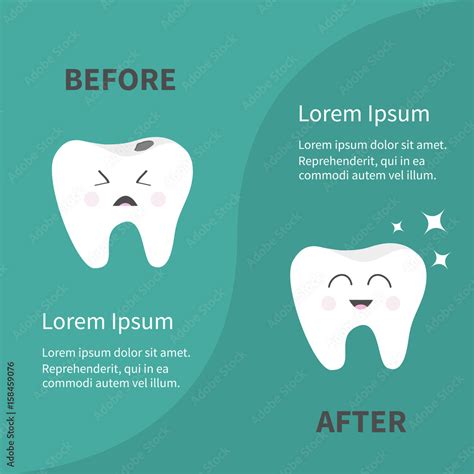 Before After Infographic Healthy Smiling Tooth Icon Shining Star