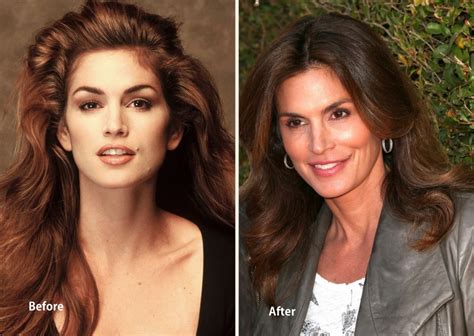 cindy crawford  years  plastic surgery  younger