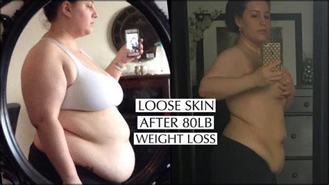 Loose Skin After Weight Loss Over 50 Disappointment Quotes