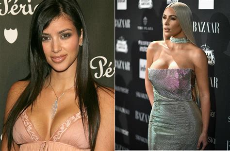 kim kardashian plastic surgery true or false past vs present photos