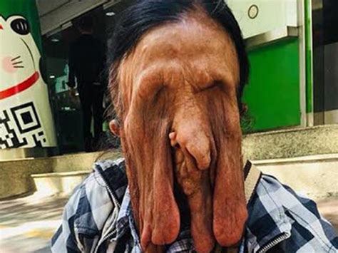 granny with a melting face refuses to undergo a surgery