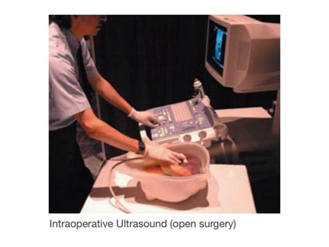 Abdominal Intraoperative And Laparoscopic Ultrasound Iousfan