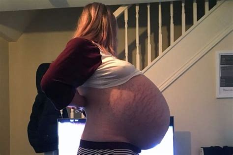 woman who doctors thought was pregnant had 26kg cyst the weight of