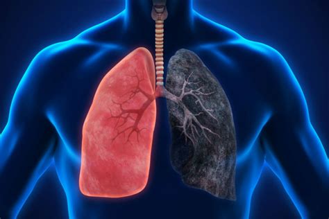 major differences  healthy lungs  smokers lungs