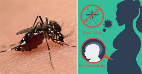 4 Signs You Ve Been Infected With Zika David Avocado Wolfe
