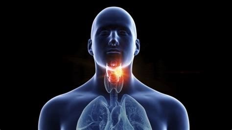 Throat Cancer Wetin Be Di Causes And Signs Of Throat Cancer Bbc