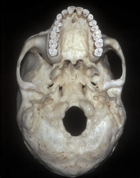 Inferior View Of Skull Base Neuroanatomy The Neurosurgical Atlas
