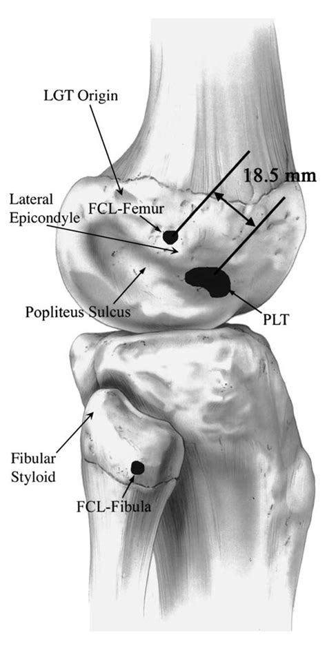 popliteus musclepopliteus complex medical anatomical knowledge center