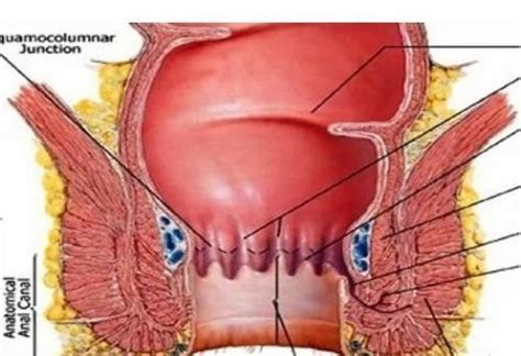 fistula     opp