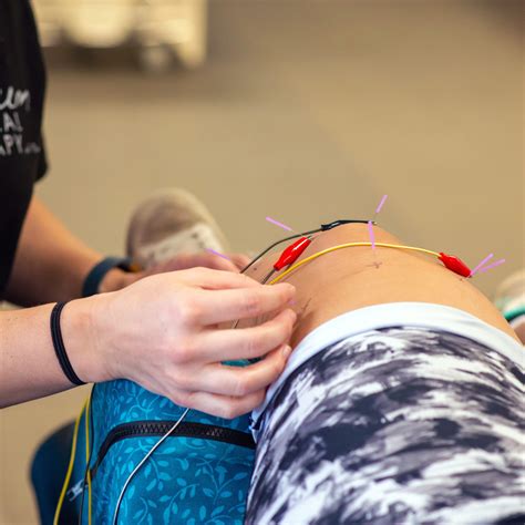 dry needling services momentum physical therapy pueblo co