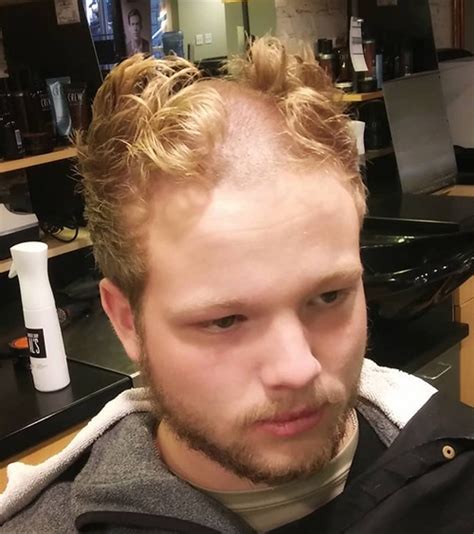 15 cool reverse mohawk hairstyles for men men s