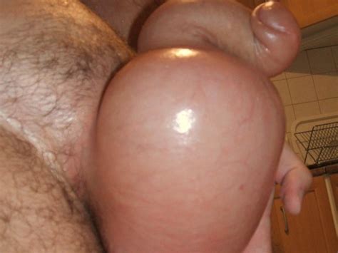 3 litre extreme saline inflation in my ball preview xtube porn video from pumperbee