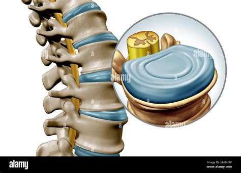 lumbar spine disk anatomy segment medical concept   close
