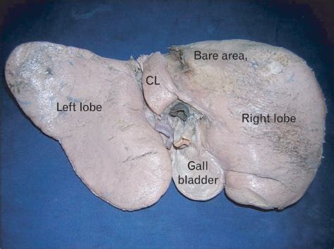 Photograph Of The Visceral Surface Of The Liver Note T Open I