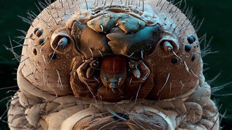 avoid  infestation  demodex mites   treatments