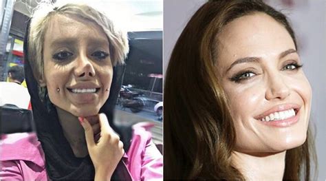 Iranian Teen Goes Through ’50 Plastic Surgeries’ To Look Like Angelina