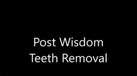 Wisdom Teeth Clips4sale
