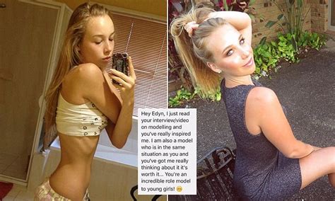 Edyn Mackney Reveals She S Been Flooded With Messages From