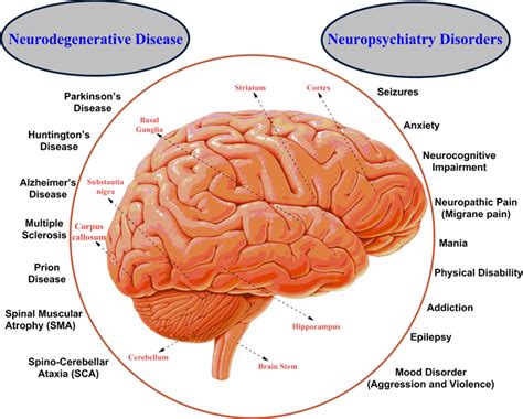 human brain disorders  review fulltext