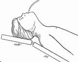 Sinus Endoscopic Surgery sketch template