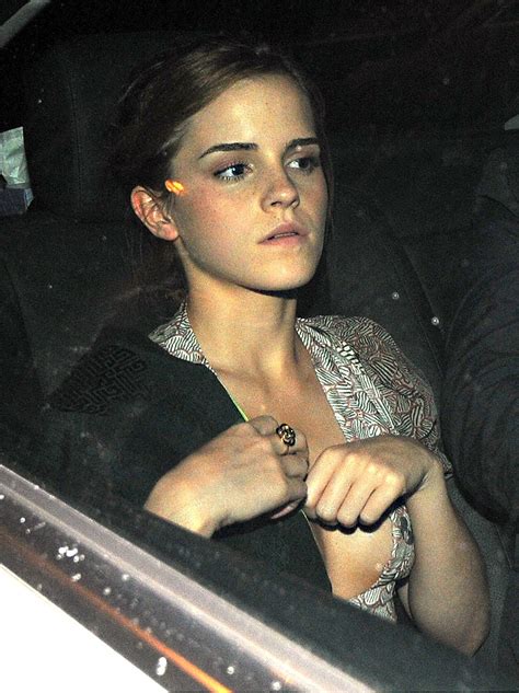 emma watson pussy and nipple slips — flashing vagina is her thing scandal planet