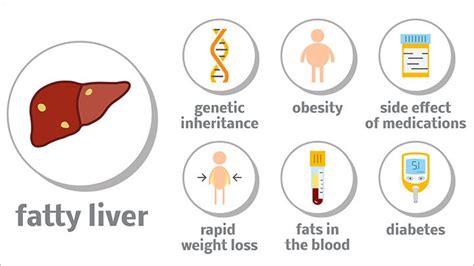 what is nonalcoholic fatty liver disease everyday health