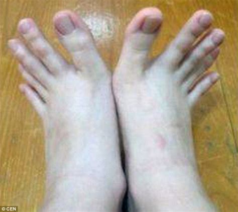 fingers or toes woman stuns internet after posting pictures of her