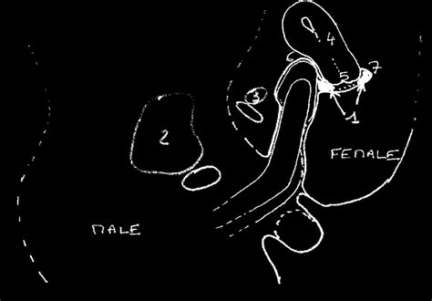 mri fourth session diagrams 1 sperm 2 male bladder 3 female