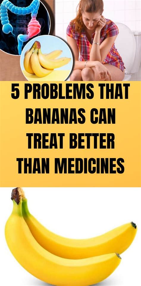 5 Problems That Bananas Can Treat Better Than Medicines Page 6 Of 6