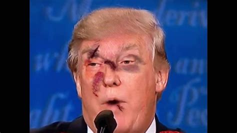 donald trump  punched   face youtube