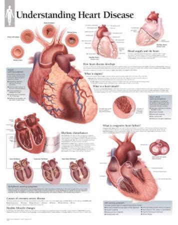 understanding heart disease educational chart poster posters