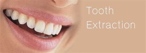 tooth extraction bangkok phuket dental center tooth extraction thailand