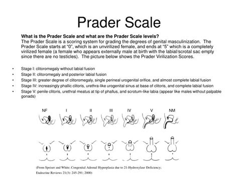 Ppt Prader Scale Powerpoint Presentation Id 6016486