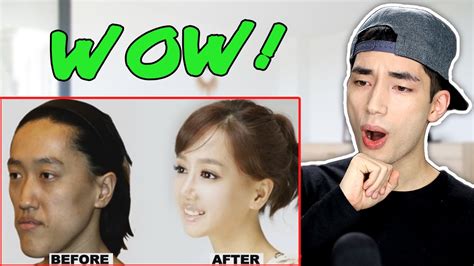 Korean Plastic Surgery Before And After Photos Reaction