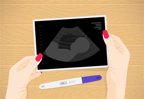 ecografias durante el embarazo vectores libres de derechos istock