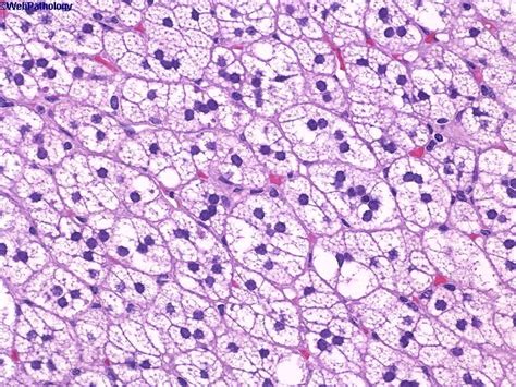 a collection of surgical pathology images pathology tutorial images