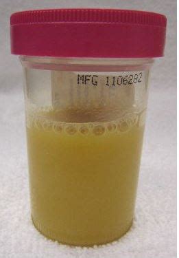 whats  normal color  dog urine daily dog discoveries