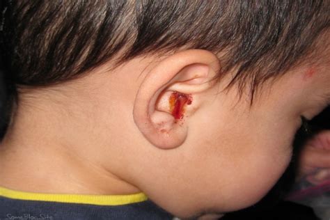 treating adult ear infections porn pictures