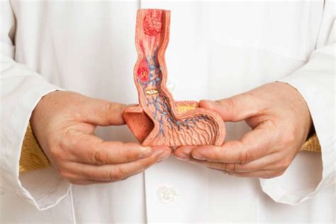 Penile Cancer Treatment Treatment And Cost Guide