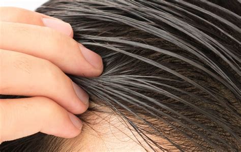 oily dry  normal hair care tips    scalp type dhi