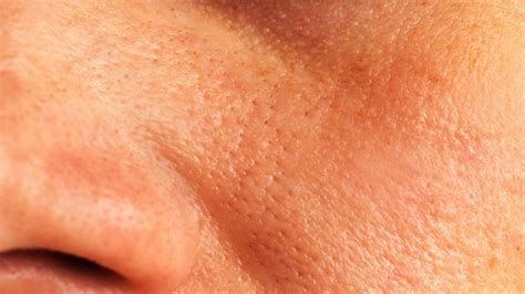minimise large pores   nose cheeks  chin   natural