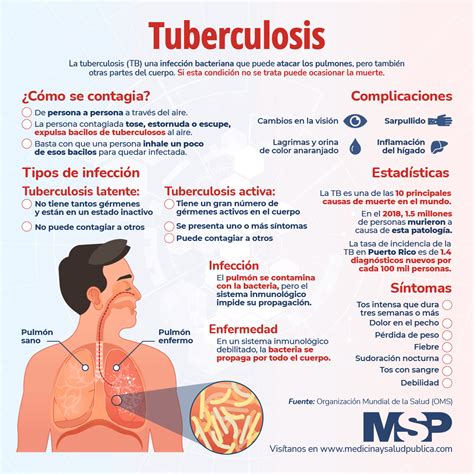 tuberculosis infografia