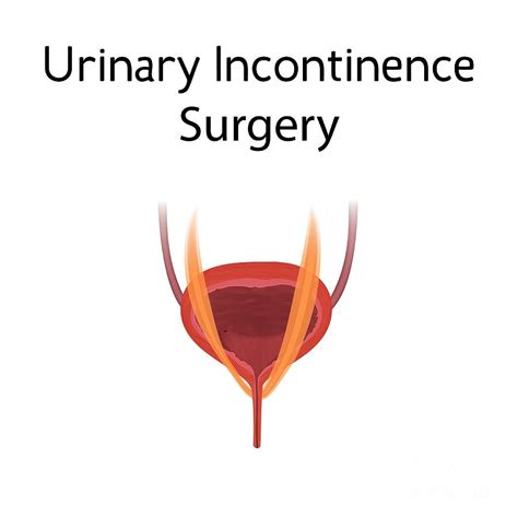 urinary incontinence surgery photograph by veronika zakharova science